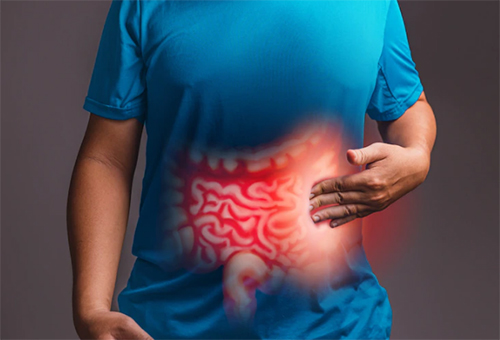 What Is Irritable Bowel Syndrome Ibs Symptoms Causes Treatment